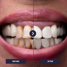 Load image into Gallery viewer, OrthoVivid 2.0